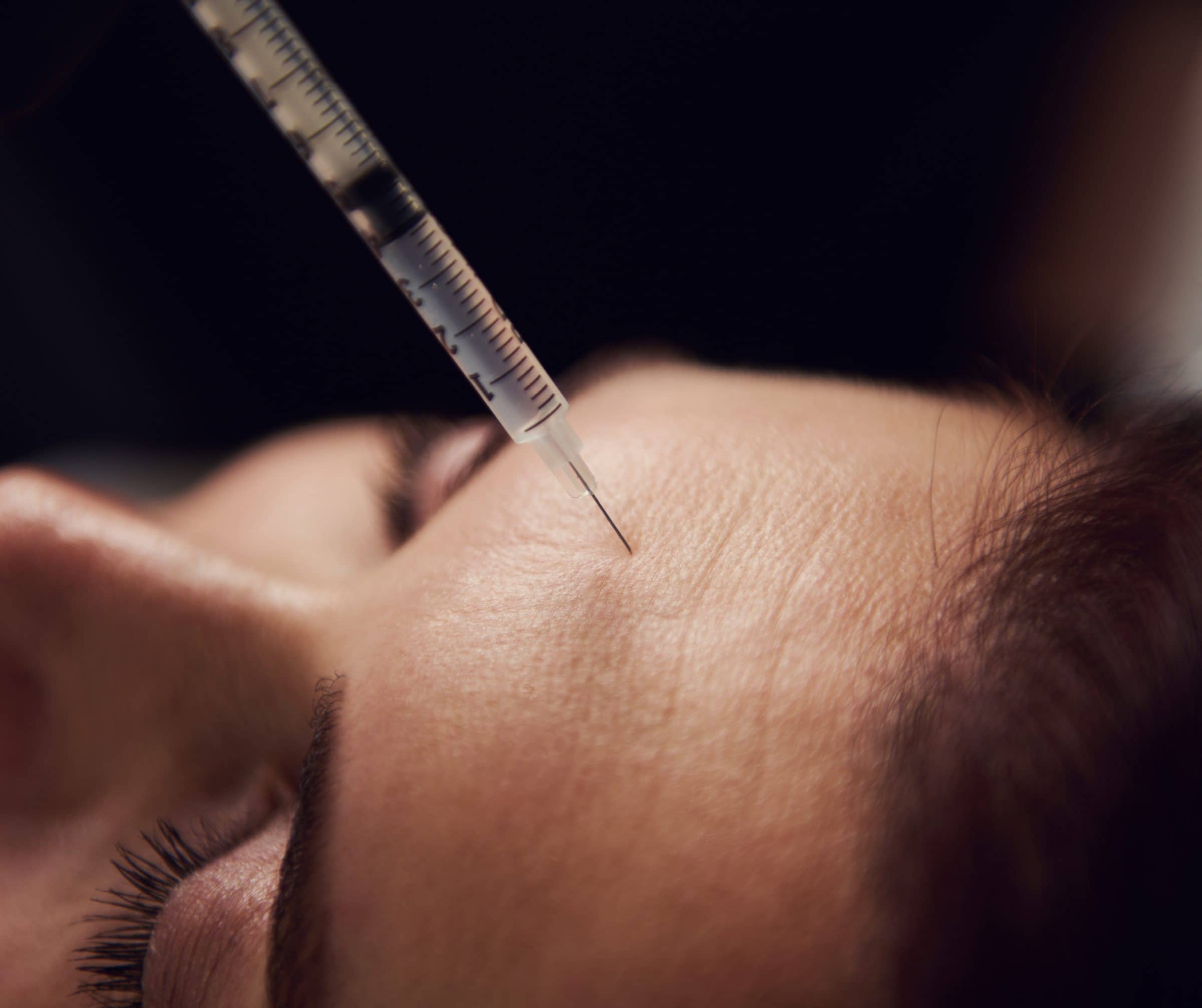 Quels sont les avantages des injections de botox au niveau du front ? | Dr Corinne Pachet | Paris